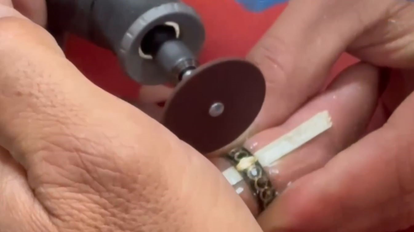 Sivas'ta Yüzük Sıkışan Vatandaşa İtfaiye Ekiplerinden Kritik Müdahale