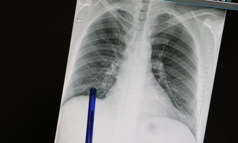 AW574080 02 | Gündem Sivas™ Haber