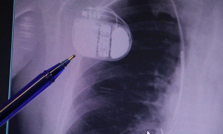 AW576546 02 | Gündem Sivas™ Haber