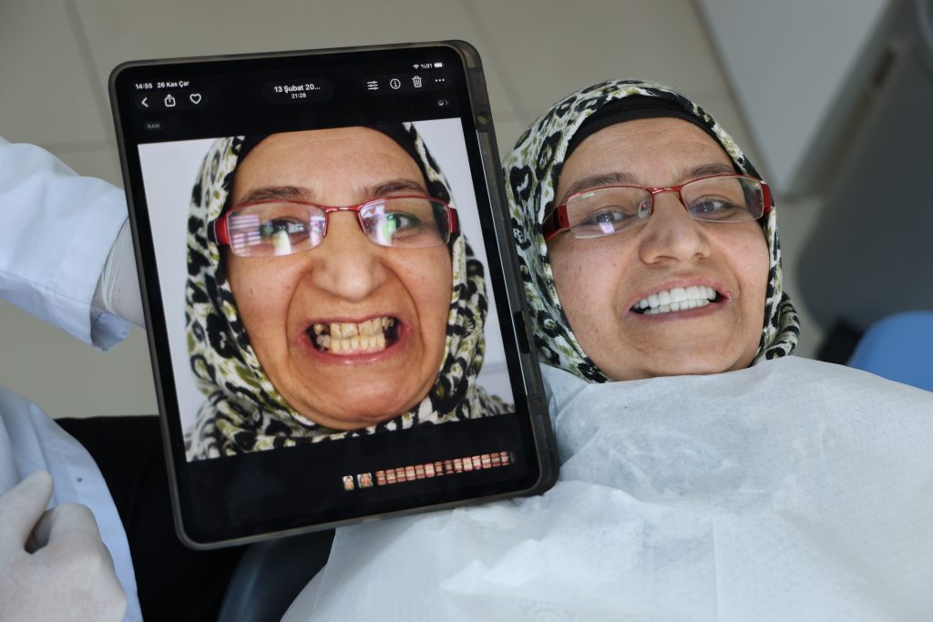 Depremden İlham Alan Türk Profesörden Diş Tedavisinde Devrim: İmplantsız İnci Gibi Gülüşler AW587883 02 | Gündem Sivas™ Haber