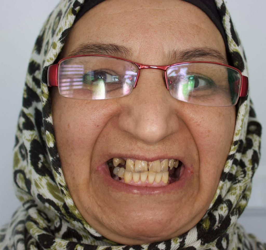 Depremden İlham Alan Türk Profesörden Diş Tedavisinde Devrim: İmplantsız İnci Gibi Gülüşler AW587883 07 | Gündem Sivas™ Haber