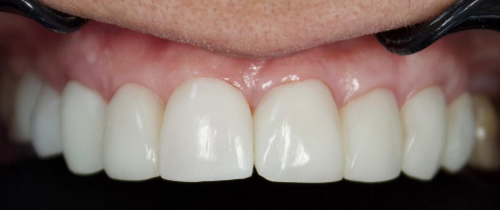 Depremden İlham Alan Türk Profesörden Diş Tedavisinde Devrim: İmplantsız İnci Gibi Gülüşler AW587883 08 | Gündem Sivas™ Haber