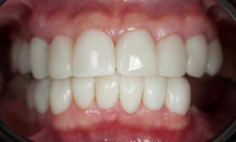 AW587883 09 | Gündem Sivas™ Haber