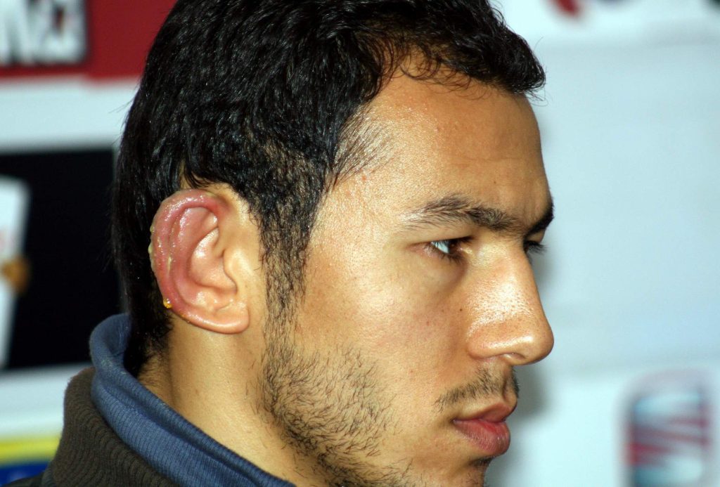 Soğuk Havalar Kapıda: Uzman Uyardı, Donma Vakalarında Gecikme Uzuv Kaybına Götürebilir AW625580 07 | Gündem Sivas™ Haber