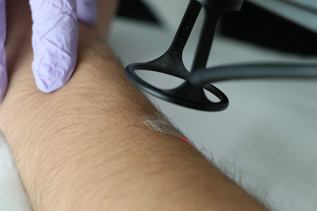 Kış Ayları Estetik Lazer İçin Neden En Güvenli Dönem? Uzmanından Cilt Sağlığını Korumaya Yönelik Kritik Uyarılar Kış Ayları Estetik Lazer İçin Neden En Güvenli Dönem? Uzmanından Cilt Sağlığını Korumaya Yönelik Kritik Uyarılar