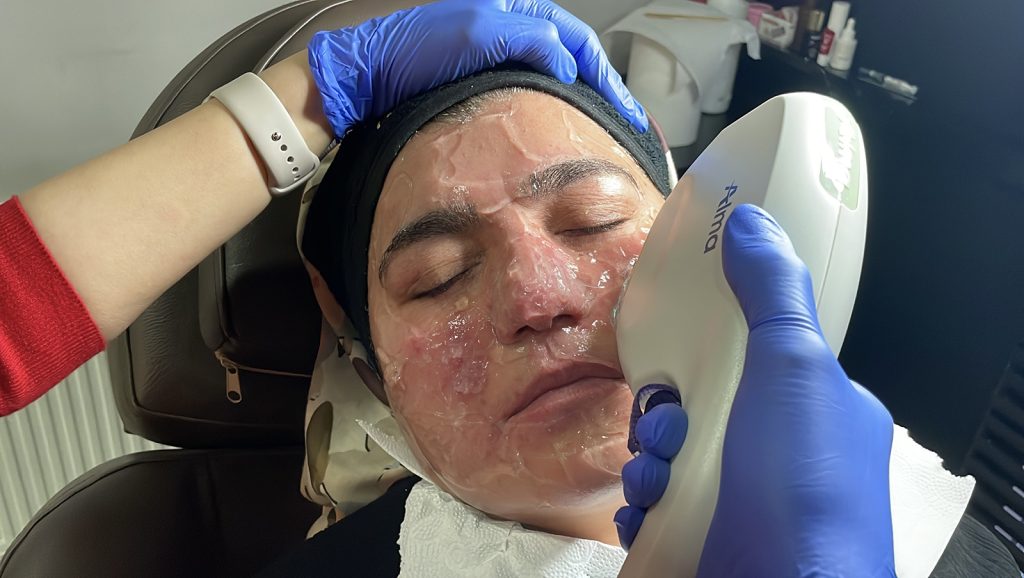 Gül Hastalığı Nedeniyle 20 Yıl Evden Çıkamadı: Sivas’ta Başlayan Tedaviyle Hayata Yeniden “Merhaba” Dedi AW646314 03 | Gündem Sivas™ Haber